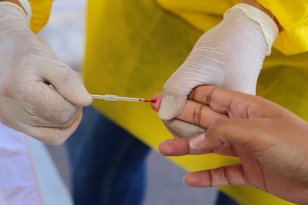 Aparecida oferece teste rápido de hepatites virais, HIV e Sífilis