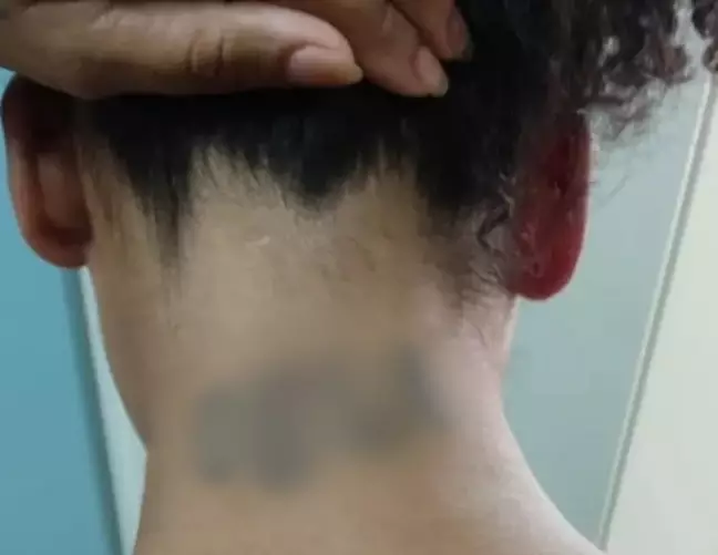 agredir tatuar